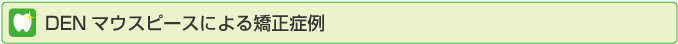 DENマウスピース矯正による症例紹介